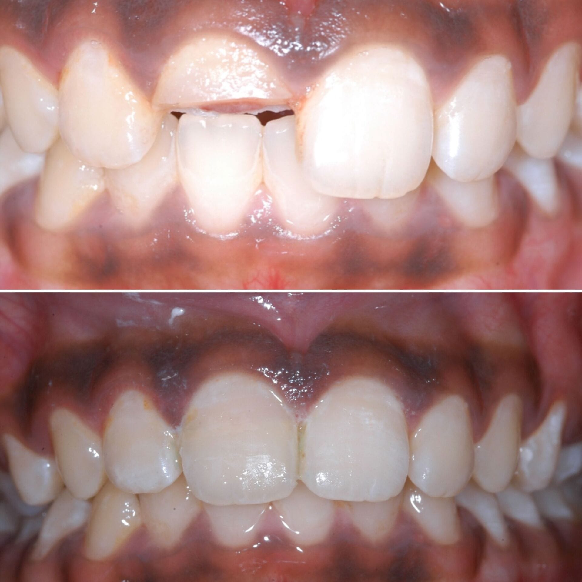children's dental emergency trauma london