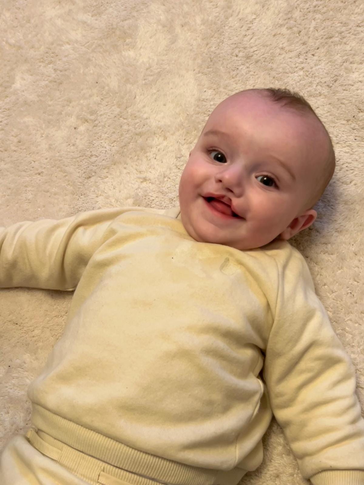 Cleft Lip & Palate Dentistry | Harley Street Dentist