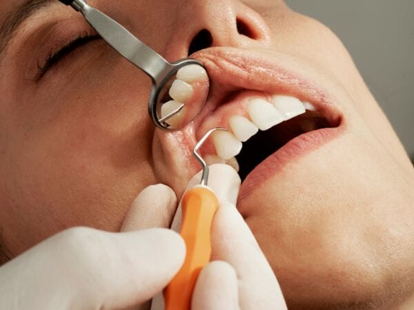 gum treatment