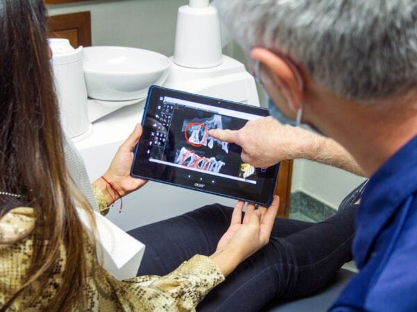 wisdom tooth extraction