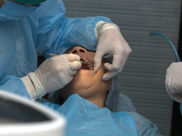 surgical tooth extraction