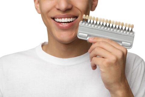 dental crowns
