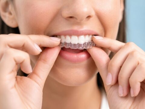 Orthodontic Relapse